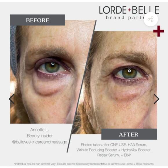 LORDE + BELLE REPAIR SERUM + WRINKLE REDUCING BOOSTER BUNDLE $188.00 SOLD OUT - Picture 3 of 5